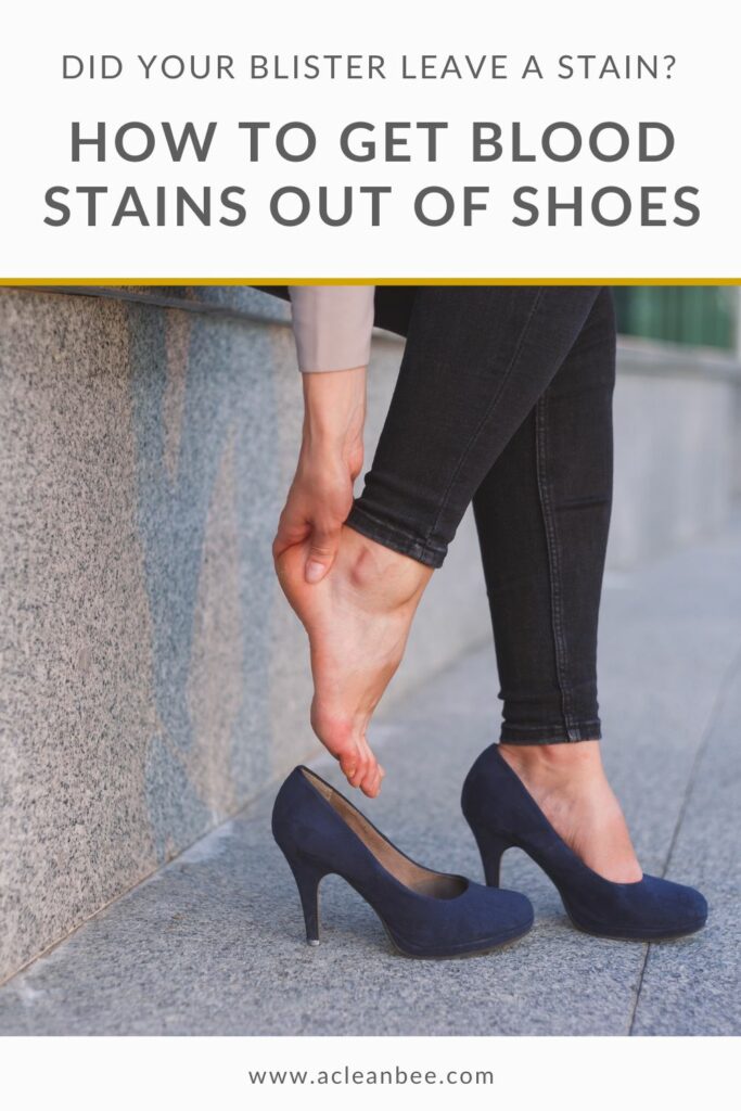 How to get blood out of shoes
