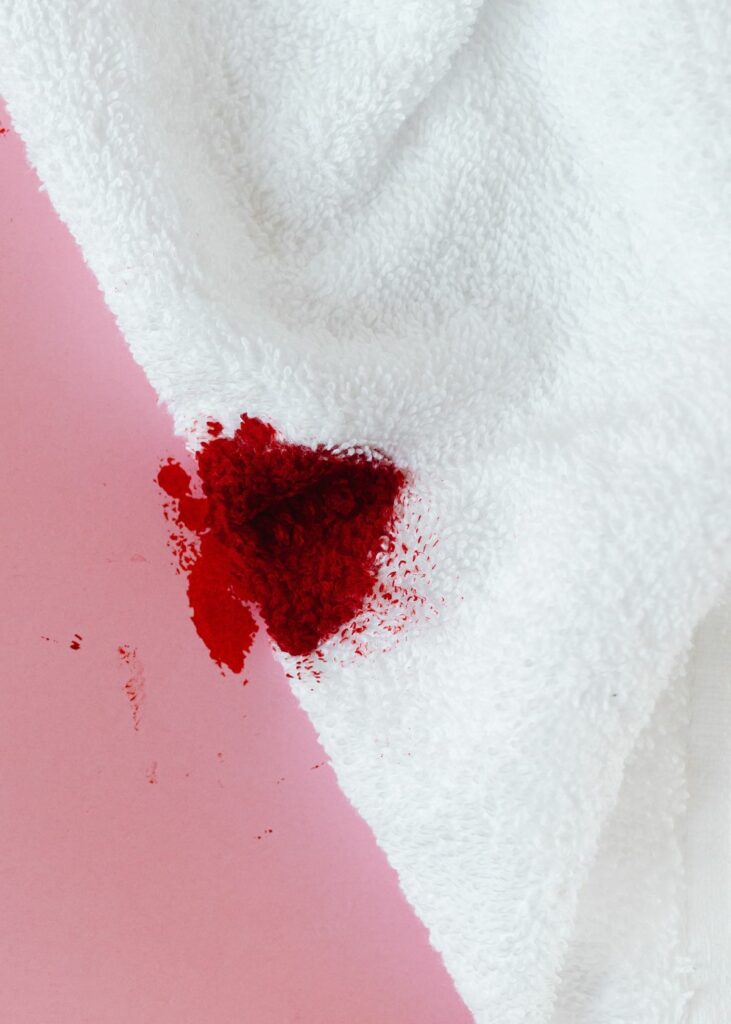 How to make white towels white - remove blood stains